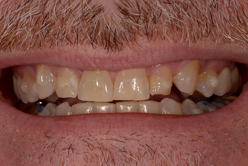 Before